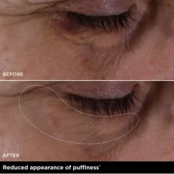 Double Serum Eye New